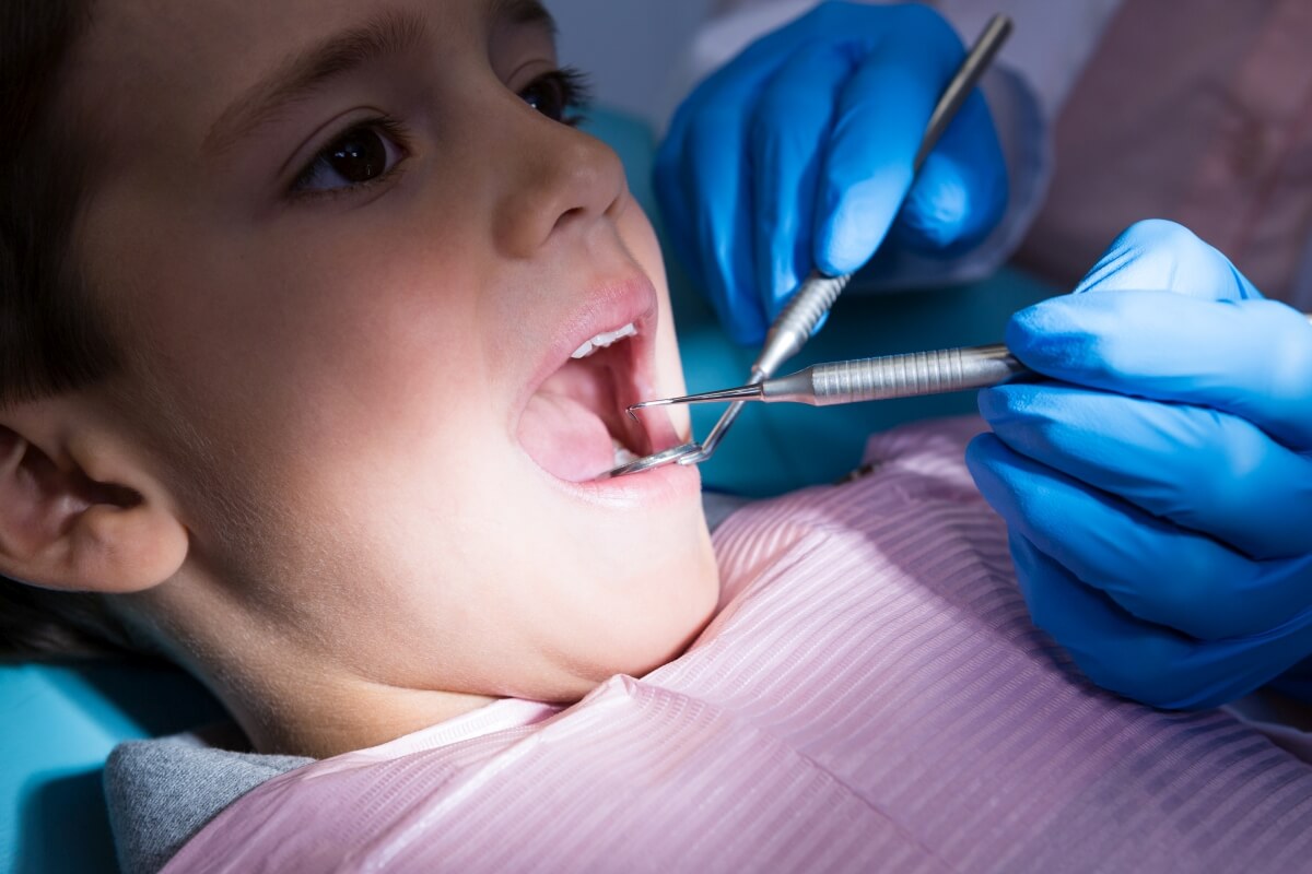 Dentysta leczący dziecko, co podkreśla zalety podtlenku azotu w leczeniu dzieci.